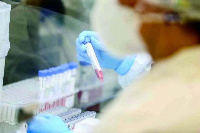 Covid-19: Brasil registra mais de 54 mil novos casos e 1.351 óbitos