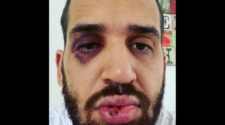 Caso do médico de Toledo agredido por alertar sobre gravidade da Covid-19 ganha repercussão nacional: “Não dá para se calar”, diz