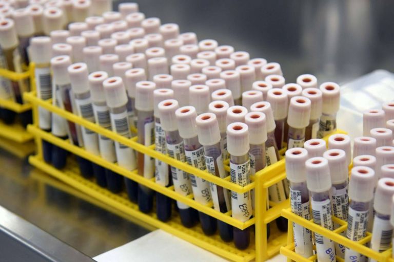 Variante Delta corresponde a 91,9% dos casos de Covid-19 em São Paulo