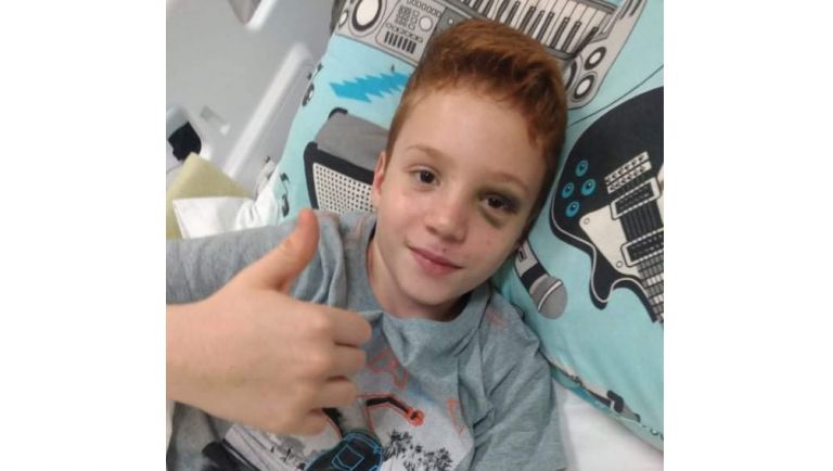 Depois de 14 dias internado, rondonense de 11 anos, vítima de grave acidente, volta para casa