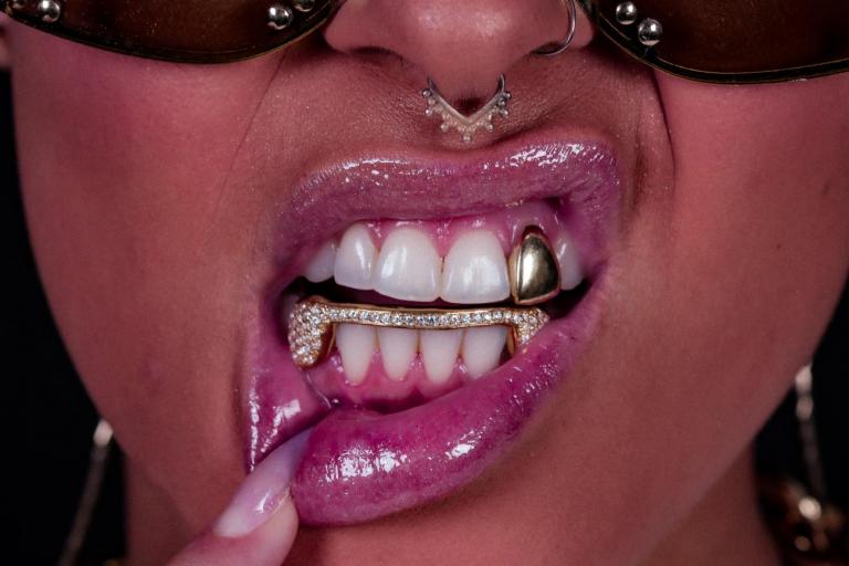 Grillz e caps: Conheça a cultura das joias dentais e seu contexto no Brasil