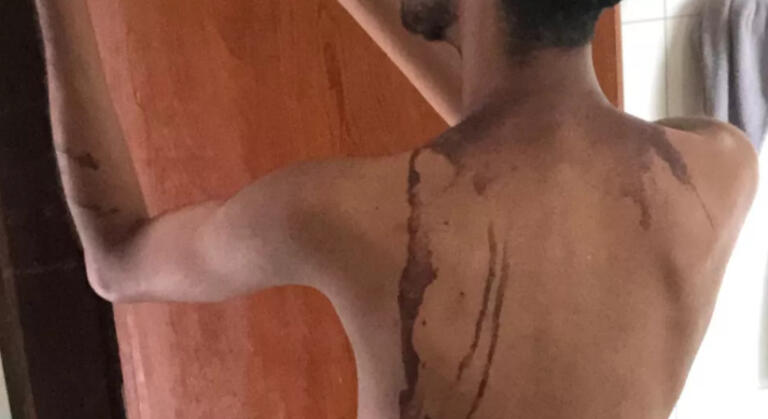 Trote em Palotina: suspeitos afirmaram à polícia que acharam que produto não causaria danos à pele