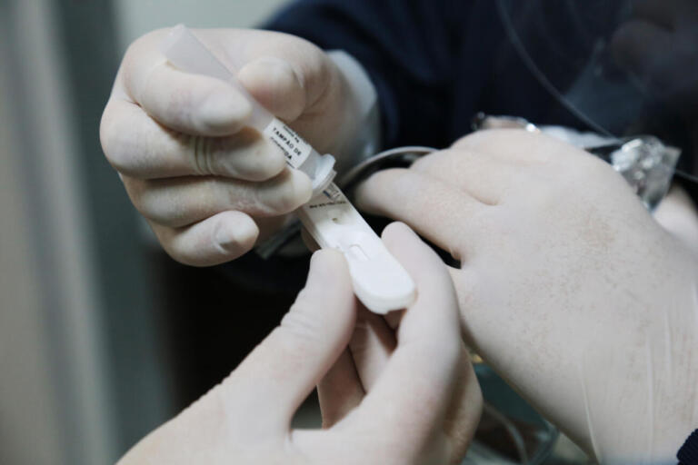 Covid-19: Brasil registra 18,2 mil novos casos e 164 óbitos