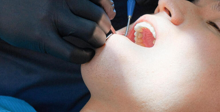 No Dia Mundial da Saúde Bucal, Uopeccan faz alerta para o câncer na região Oeste do Paraná