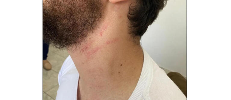 Mãe de professor agredido por delegado da PF diz que filho está ‘debilitado emocionalmente’ e ajuda mulher a lutar contra câncer