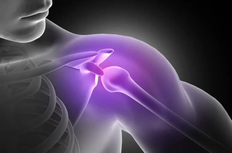 Saiba o que é a Síndrome do Manguito Rotador, enfermidade que mais afastou paranaenses do trabalho em 2023