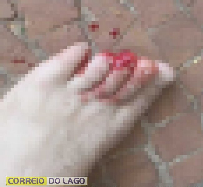 Homem tem parte do dedo do pé arrancado em suposto ataque de piranhas no Balneário Terra das Águas