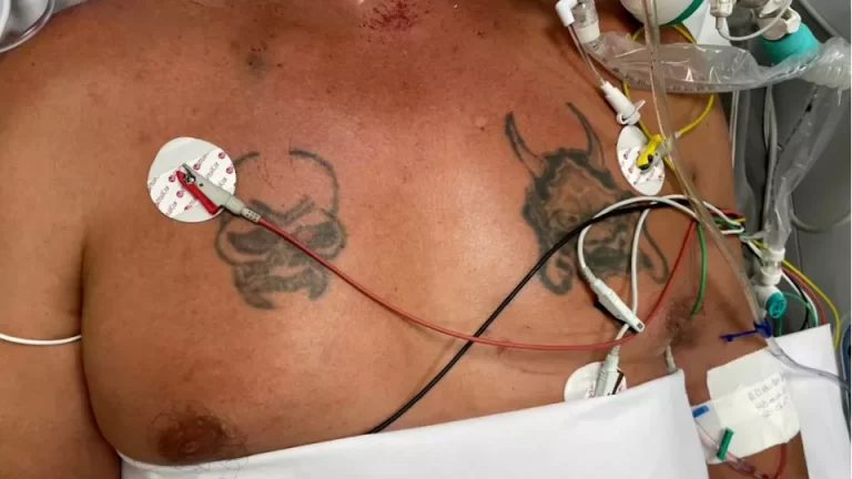 Homem socorrido em acidente de trânsito em Santa Helena precisa ser identificado