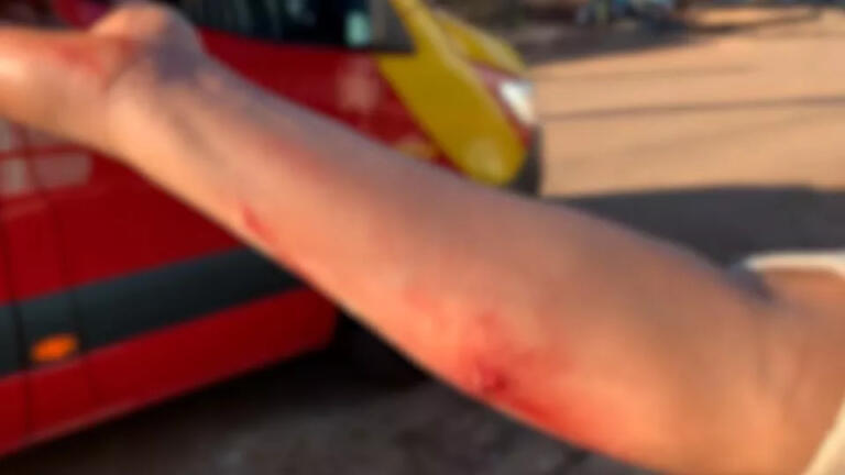 Cascavel registra cinco feridos por ataques de pitbulls em 11 dias