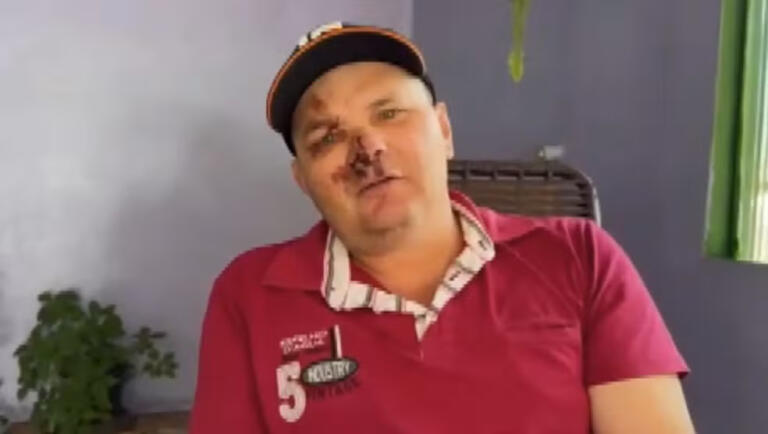 Trabalhador sobrevive após ficar por cerca de uma hora soterrado em obra no Paraná