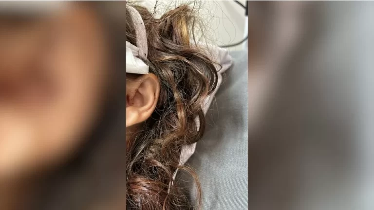 Hospital Universitário pede ajuda para identificar paciente