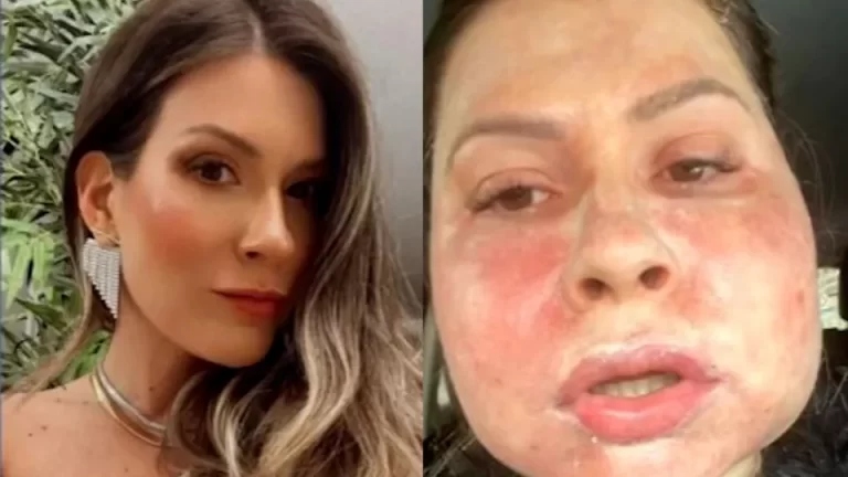 Defesa de clínica investigada por deformidade no rosto de paciente nega acusações; veja nota