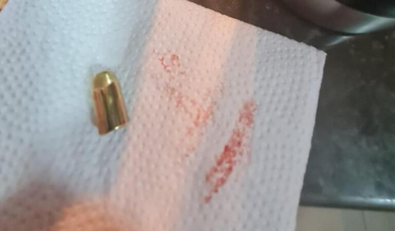 Criança é atingida por bala perdida em Foz do Iguaçu durante queima de fogos; veja vídeo