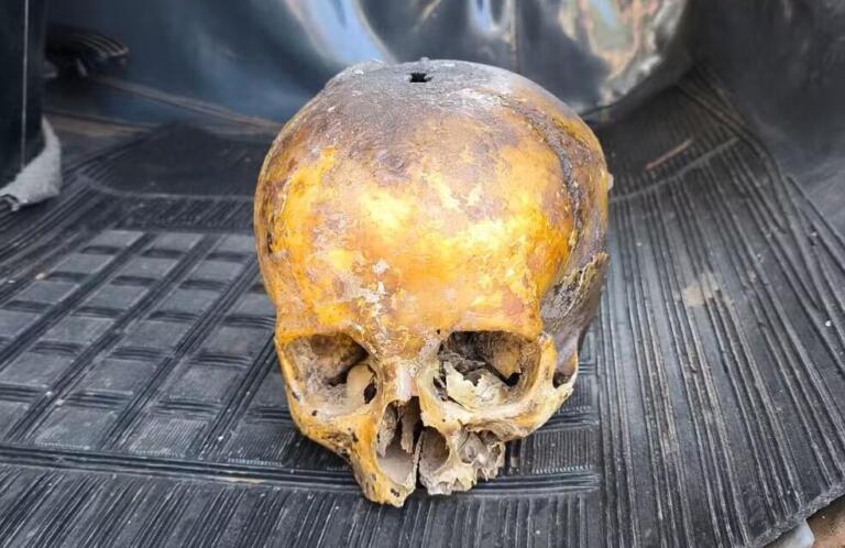 Crânio usado como decoração é jogado no lixo; caso está em investigação