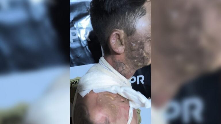 Mulher é presa após jogar panela de água fervendo em homem em Palotina