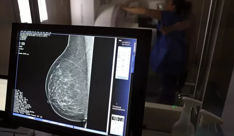 Câncer de mama: uma em cada três pacientes tem menos de 50 anos