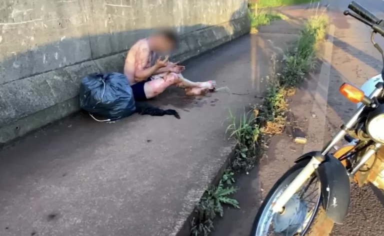 Homem é incendiado após briga na marginal da BR-277 em Cascavel