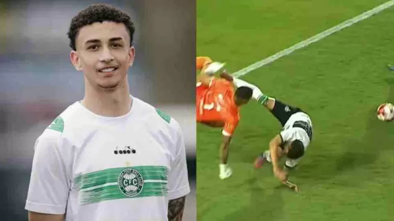 Atacante do Coritiba sofre fratura exposta no antebraço em estreia no Paranaense