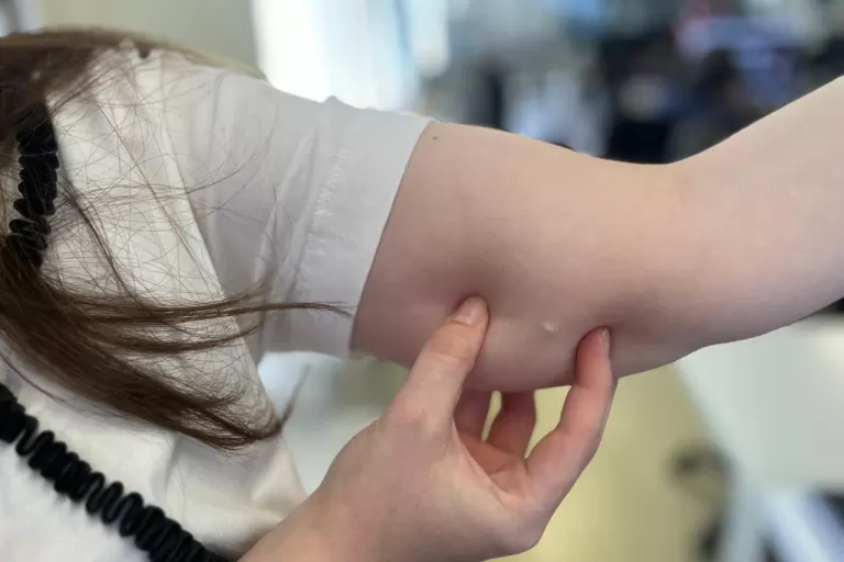 Procura por implante contraceptivo cresce 118% no SUS do Paraná em 2025