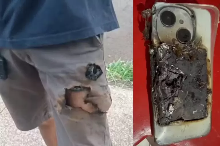 Mecânico é atacado por cachorros, animal morde celular e aparelho explode no bolso do homem