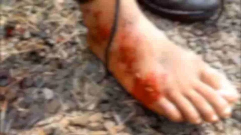 Motociclista fica ferido após bater moto em onça e ser mordido